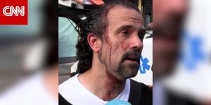 إيطاليا: سائق دهس مشاة فوق رصيف.. وشخص تعرض لطعنات منه يروي لحظات منعه من الفرار