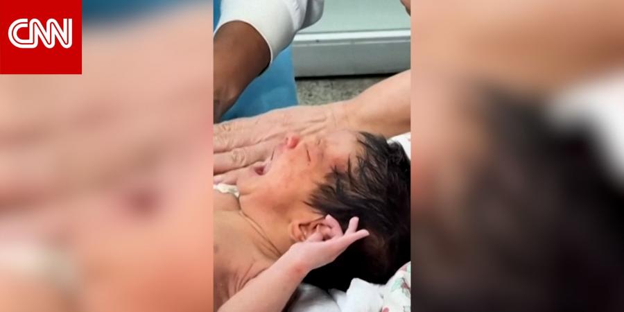 رضيع بعمر 18 يوماً ينجو بعد 32 ساعة تحت أنقاض زلزالي فنزويلا